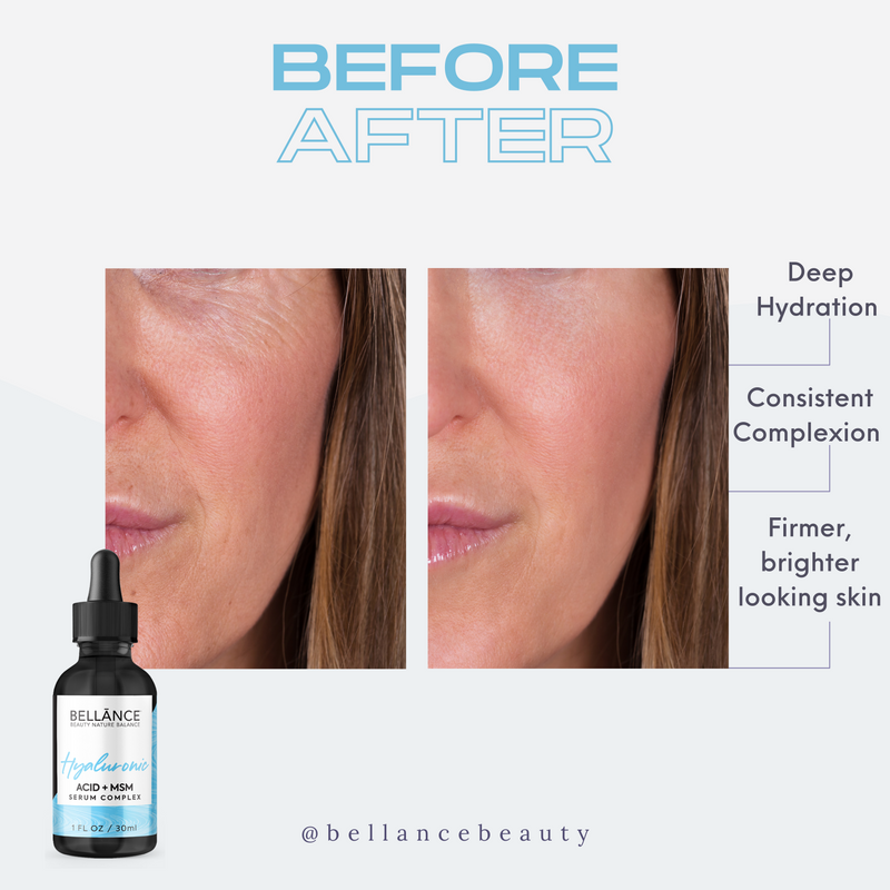 Bellance Hyaluronic Acid Serum with MSM
